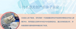 怀孕了云浮如何做产前亲子鉴定，云浮办理孕期亲子鉴定结果准吗